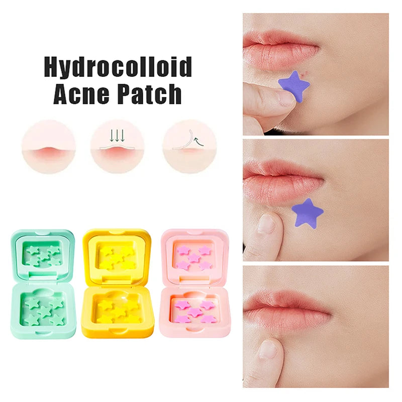 New 1Box25/48 Patches Hydrocolloid Acne Patch Fade Repair Invisible Acne Removal Stickers Concealer Makeup Tool Star With Mirror