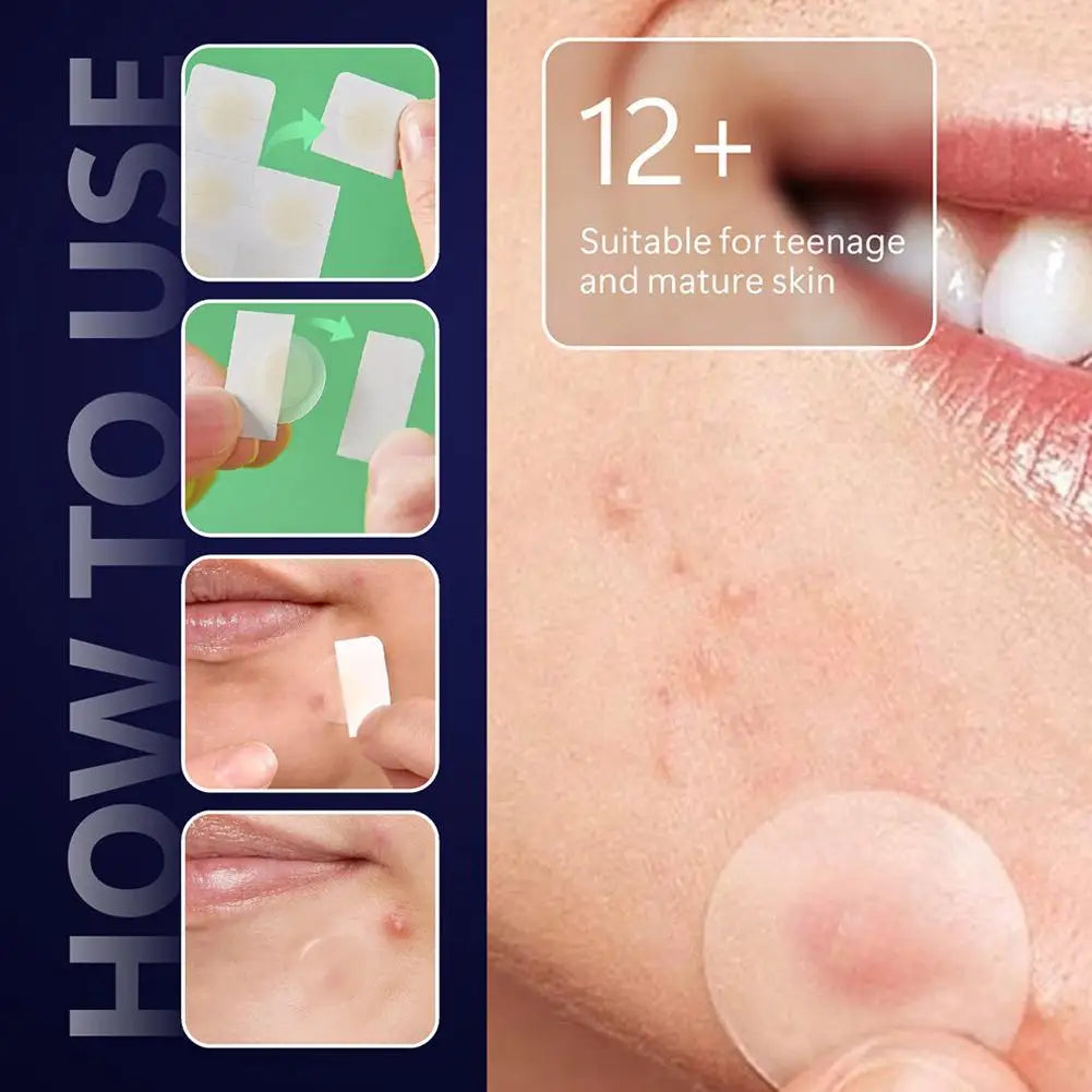 Hydrocolloid Pimple Patch Micro Needle Acne Patches Ultra-thin Invisible 8 Hours Effective  Acne Cover Sticker Facial Care Tool