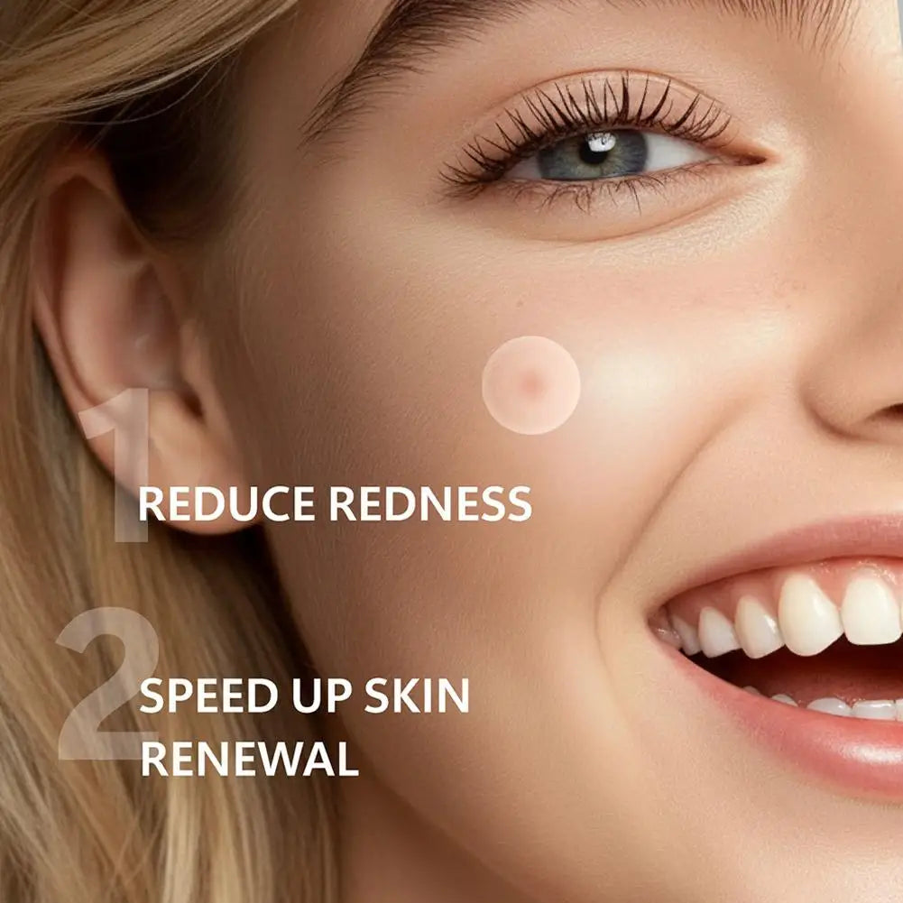 Hydrocolloid Pimple Patch Micro Needle Acne Patches Ultra-thin Invisible 8 Hours Effective  Acne Cover Sticker Facial Care Tool